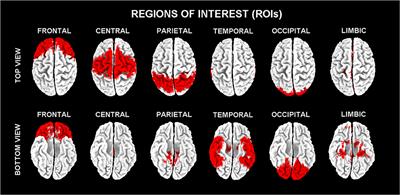 Classification of Healthy Subjects and Alzheimer's Disease Patients with Dementia from Cortical Sources of Resting State EEG Rhythms: A Study Using Artificial Neural Networks